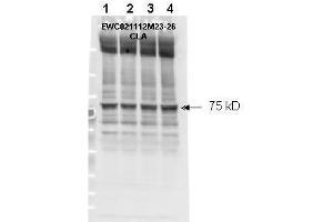 Affinity purified phospho-specific antibody to NF2 (Merlin) at pS518 was used at a 1:1000 dilution to detect NF2 by Western blot. (Merlin 抗体  (pSer518))