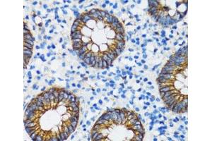 Immunohistochemistry (Paraffin-embedded Sections) (IHC (p)) image for anti-Catenin (Cadherin-Associated Protein), alpha 1, 102kDa (CTNNA1) antibody (ABIN7261582)