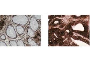 Immunohistochemistry (IHC) image for anti-Chaperonin Containing TCP1, Subunit 2 (Beta) (CCT2) (C-Term) antibody (ABIN264513) (CCT2 抗体  (C-Term))