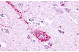 Anti-GPR61 antibody  ABIN1048846 IHC staining of human brain, neurons and glia. (GPR61 抗体  (N-Term))