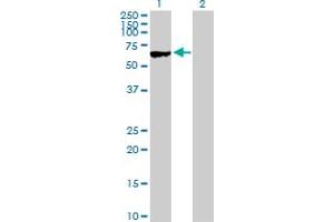 Western Blot analysis of MYBPH expression in transfected 293T cell line by MYBPH MaxPab polyclonal antibody. (MYBPH 抗体  (AA 1-477))