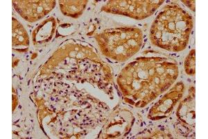 IHC image of ABIN7169172 diluted at 1:100 and staining in paraffin-embedded human kidney tissue performed on a Leica BondTM system. (Sbk2 抗体  (AA 62-330))