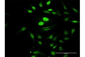 Immunofluorescence of purified MaxPab antibody to PTMS on HeLa cell. (Parathymosin 抗体  (AA 1-102))