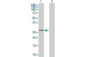 Western Blotting (WB) image for anti-Solute Carrier Family 25 (Mitochondrial Carrier, Adenine Nucleotide Translocator), Member 5 (SLC25A5) (AA 1-298) antibody (ABIN1327651)