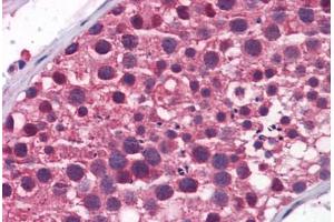 Human Testis: Formalin-Fixed, Paraffin-Embedded (FFPE) (TDRD9 抗体  (AA 1071-1120))
