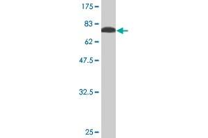 Western Blot detection against Immunogen (76. (STK38L 抗体  (AA 1-464))