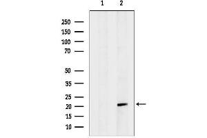 Western blot analysis of lysates from 3, using Hsp Antibody. (HspB4 (Internal Region) 抗体)