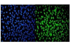 IF analysis of USP16 using anti-USP16 antibody (ABIN7602640). (USP16 抗体  (AA 9-823))