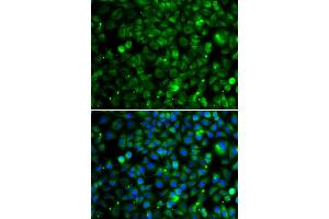 Immunofluorescence analysis of MCF-7 cells using TMLHE antibody (ABIN4905441). (TMLHE 抗体)