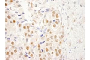 Immunohistochemistry (IHC) image for anti-Nuclear Receptor Binding Factor 2 (NRBF2) (AA 125-175) antibody (ABIN7448699) (NRBF2 抗体  (AA 125-175))