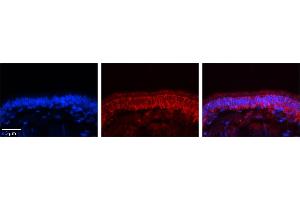 Rabbit Anti-C14orf166 Antibody     Formalin Fixed Paraffin Embedded Tissue: Human Bronchial Epithelial Tissue  Observed Staining: Cytoplasmic  Primary Antibody Concentration: 1:100  Secondary Antibody: Donkey anti-Rabbit-Cy3  Secondary Antibody Concentration: 1:200  Magnification: 20X  Exposure Time: 0. (C14orf166 抗体  (N-Term))
