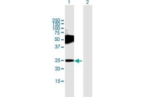 Western Blot analysis of TMEM123 expression in transfected 293T cell line by TMEM123 MaxPab polyclonal antibody. (TMEM123 抗体  (AA 1-208))