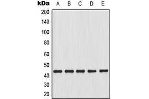 Western blot analysis of Connexin 43 expression in C6 (A), HeLa (B), C2C12 (C), mouse heart (D), rat brain (E) whole cell lysates. (Connexin 43/GJA1 抗体  (C-Term))
