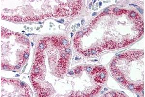 Immunohistochemistry (Paraffin-embedded Sections) (IHC (p)) image for anti-Matrix Metalloproteinase 2 (MMP2) (AA 468-483) antibody (ABIN337360)