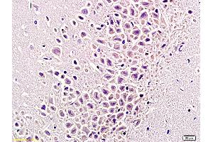 Immunohistochemistry (IHC) image for anti-Tumor Necrosis Factor alpha (TNF alpha) (AA 181-235) antibody (ABIN677318)