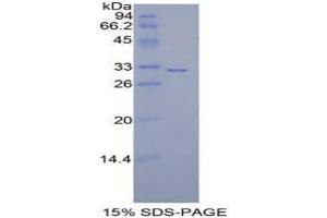 SDS-PAGE analysis of Mouse MAP2K7 Protein. (MAP2K7 蛋白)