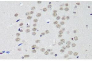 Immunohistochemistry of paraffin-embedded Mouse brain using CTCF Polyclonal Antibody at dilution of 1:200 (40x lens). (CTCF 抗体)