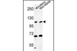 Western blot analysis of EXTL3 Antibody (N-term) (ABIN652990 and ABIN2842629) in MDA-M, MDA-M cell line lysates (35 μg/lane). (EXTL3 抗体  (N-Term))