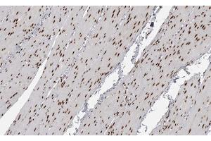 ABIN6267591 at 1/200 staining human Smooth muscle tissue sections by IHC-P. (MEF2A 抗体  (pThr319))