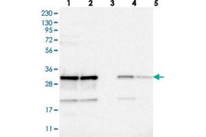 Western blot analysis of Lane 1: RT-4, Lane 2: U-251 MG, Lane 3: Human Plasma, Lane 4: Liver, Lane 5: Tonsil with CCDC43 polyclonal antibody  at 1:250-1:500 dilution. (CCDC43 抗体)