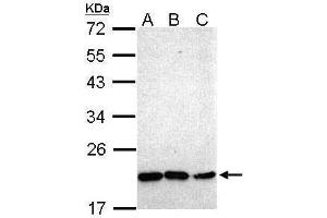 WB Image Sample (30 ug of whole cell lysate) A: Hep G2 , B: Molt-4 , C: Raji 12% SDS PAGE antibody diluted at 1:1000 (NKX2-8 抗体)