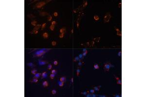 Immunofluorescence analysis of NIH/3T3 cells using MAP1LC3B antibody (ABIN6291775) at dilution of 1:100. (LC3B 抗体)