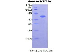 SDS-PAGE (SDS) image for Keratin 10 (KRT10) (AA 153-456) protein (His tag) (ABIN1877868) (Keratin 10 Protein (KRT10) (AA 153-456) (His tag))
