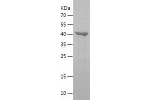 GTPBP3 Protein (AA 282-492) (His-IF2DI Tag)