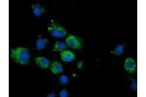 Anti-CALCOCO2 mouse monoclonal antibody (ABIN2453914) immunofluorescent staining of COS7 cells transiently transfected by pCMV6-ENTRY CALCOCO2 (RC203843). (CALCOCO2 抗体)