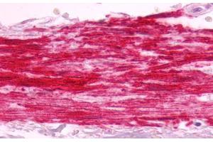 Image no. 2 for anti-Bradykinin Receptor B1 (BDKRB1) (Cytoplasmic Domain) antibody (ABIN1048348) (BDKRB1 抗体  (Cytoplasmic Domain))