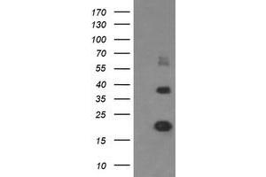 Image no. 5 for anti-Malignant T Cell Amplified Sequence 1 (MCTS1) (AA 1-181) antibody (ABIN1490598) (MCTS1 抗体  (AA 1-181))