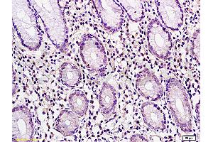 Immunohistochemistry (IHC) image for anti-Cancer/testis Antigen 2 (CTAG2) (AA 121-210) antibody (ABIN721135) (CTAG2 抗体  (AA 121-210))