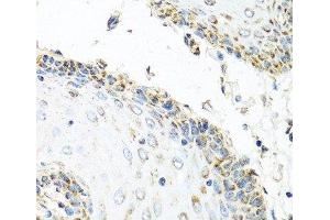 Immunohistochemistry of paraffin-embedded Human esophagus using GNRH2 Polyclonal Antibody at dilution of 1:100 (40x lens). (GnRH2 抗体)