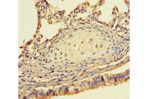 Immunohistochemistry of paraffin-embedded human lung tissue using ABIN7142194 at dilution of 1:100 (26S Proteasome Complex Subunit SEM1 (SEM1) (AA 1-70) 抗体)