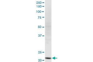Western Blotting (WB) image for anti-NADH Dehydrogenase (Ubiquinone) Flavoprotein 2, 24kDa (NDUFV2) (AA 150-249) antibody (ABIN518268)
