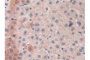 Detection of MASP2 in Human Liver Tissue using Polyclonal Antibody to Mannose Associated Serine Protease 2 (MASP2) (Mannose Associated Serine Protease 2 (AA 445-683) 抗体)