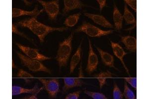 Immunofluorescence analysis of L929 cells using AGR2 Polyclonal Antibody at dilution of 1:100. (AGR2 抗体)