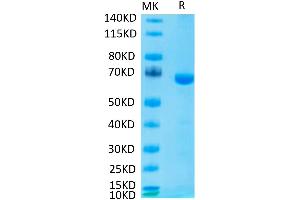 SDS-PAGE (SDS) image for Lymphocyte-Activation Gene 3 (LAG3) (AA 23-442) protein (His tag) (ABIN7275116)