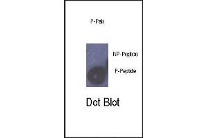 Dot blot analysis of anti-Phospho-Rb- Antibody (ABIN389644 and ABIN2839636) on nitrocellulose membrane. (Retinoblastoma 1 抗体  (pSer780))