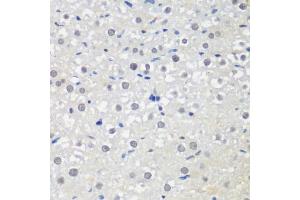 Immunohistochemistry of paraffin-embedded rat liver using CTCF antibody (ABIN6130043, ABIN6139180, ABIN6139182 and ABIN6217207) at dilution of 1:200 (40x lens). (CTCF 抗体  (AA 1-260))