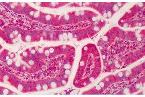 Human Small Intestine: Formalin-Fixed, Paraffin-Embedded (FFPE) (Forkhead Box K2 抗体  (AA 491-540))