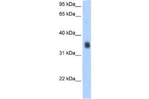 WB Suggested Antibody Titration:  2. (SLC35F2 抗体  (N-Term))