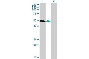 Western Blot analysis of LSP1 expression in transfected 293T cell line by LSP1 monoclonal antibody (M07), clone 1C4. (LSP1 抗体  (AA 240-338))