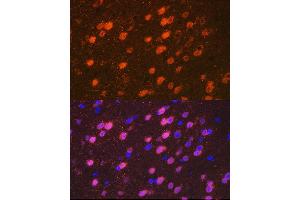 Immunofluorescence analysis of mouse brain cells using TBR1 Rabbit mAb (ABIN7270703) at dilution of 1:100 (40x lens). (TBR1 抗体)