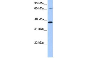 HMBS antibody used at 1 ug/ml to detect target protein. (HMBS 抗体  (N-Term))