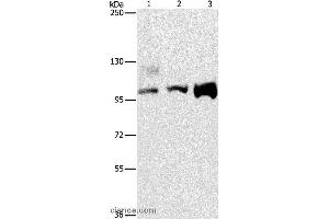 Western blot analysis of A431, 293T and hela cell, using ASCC2 Polyclonal Antibody at dilution of 1:500 (ASCC2 抗体)