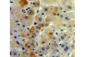 Used in DAB staining on fromalin fixed paraffin-embedded Liver tissue (FAS 抗体  (AA 22-169))