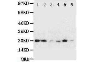 Western Blotting (WB) image for anti-Heat Shock 27kDa Protein 2 (HSPB2) (AA 102-118), (Middle Region) antibody (ABIN3044185) (HSPB2 抗体  (Middle Region))
