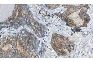 ABIN6269165 at 1/100 staining Human prostate tissue by IHC-P.