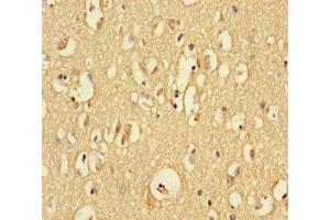 Immunohistochemistry of paraffin-embedded human brain tissue using ABIN7167749 at dilution of 1:100 (RTN4RL1 抗体  (AA 201-420))